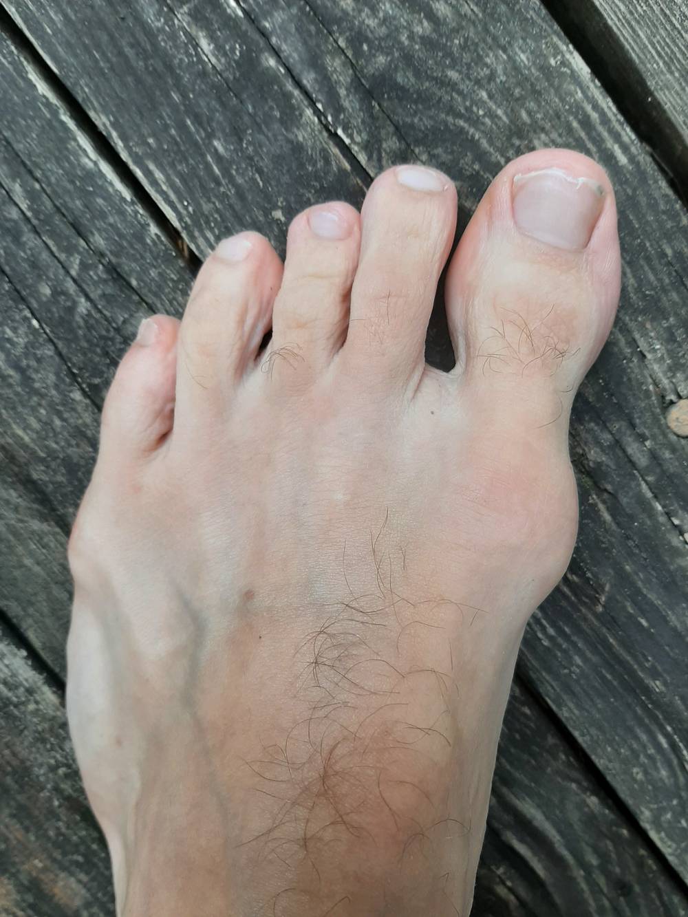 Mister Nice Foot OnlyFans – free nudes, naked, leaked