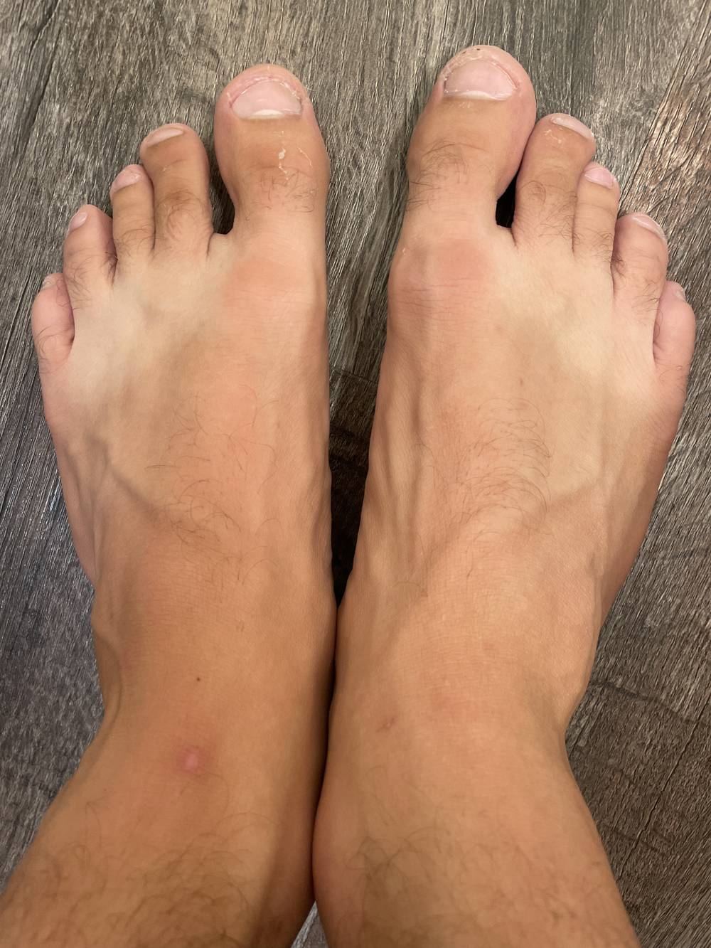 Random Feet OnlyFans – free nudes, naked, leaked