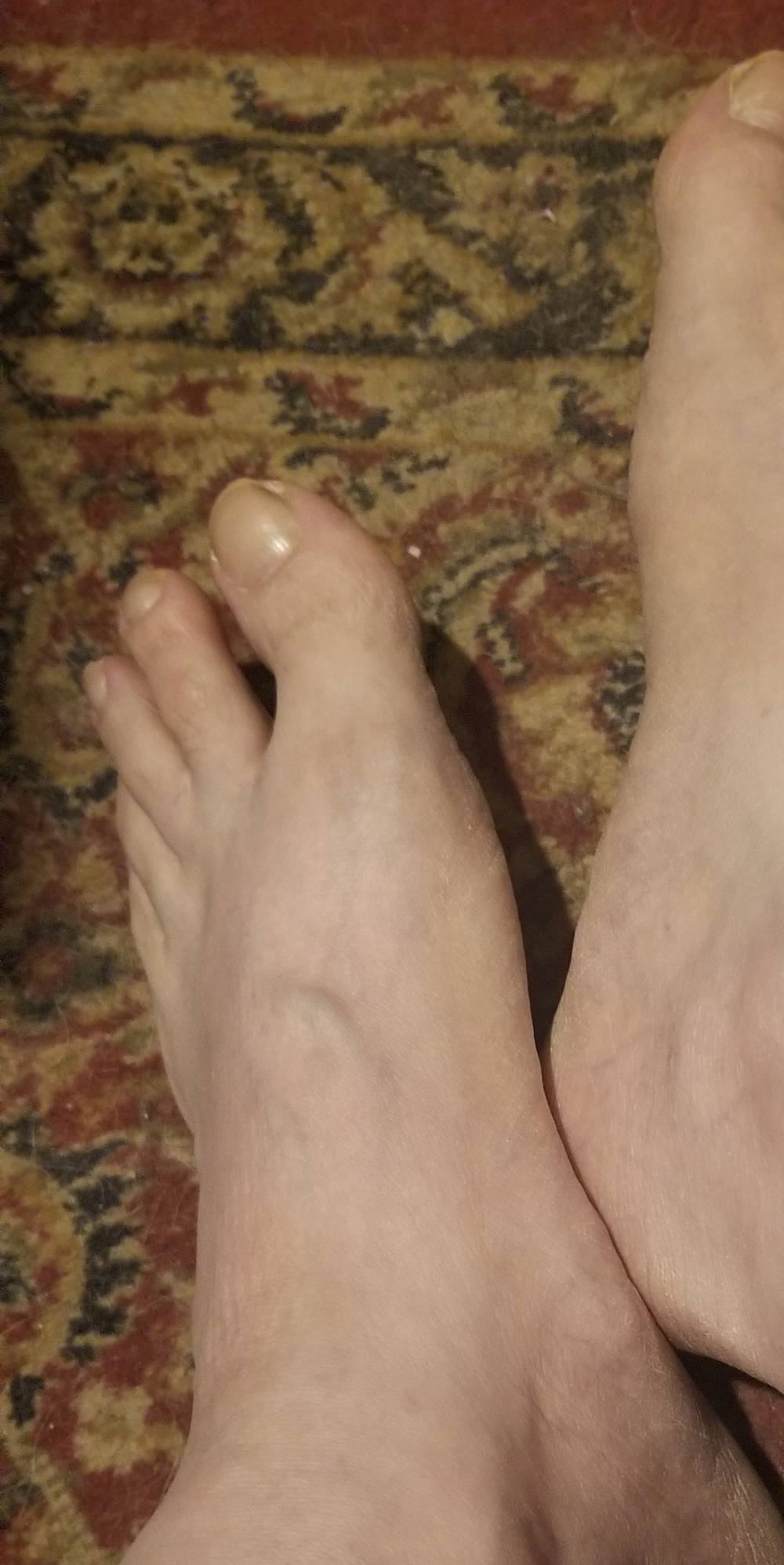 MeesterFeet