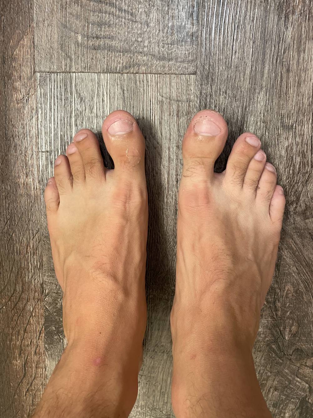 Random Feet