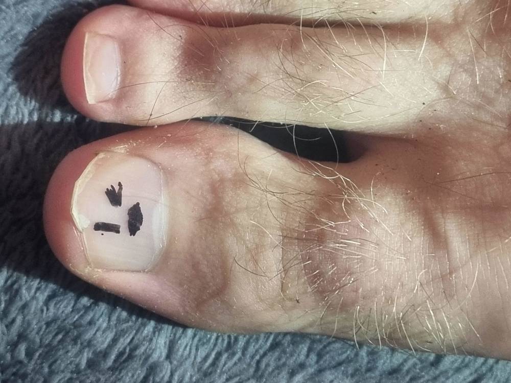 Furry feet